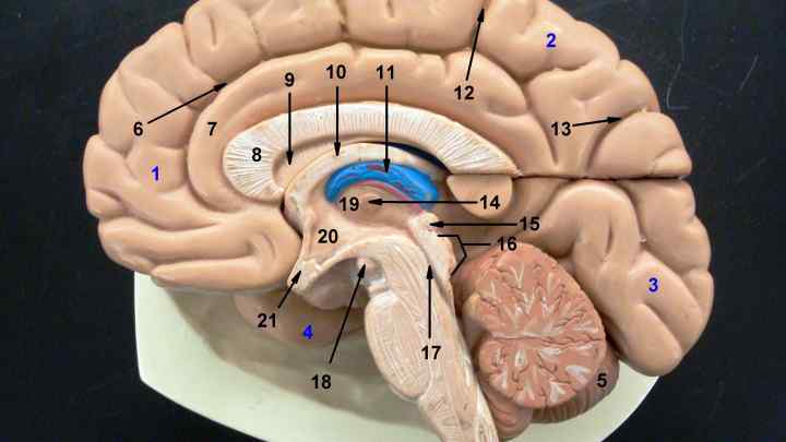 Кіста прозорої перегородки головного мозку